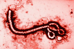 Ebola virus shown at 108,000 magnification.